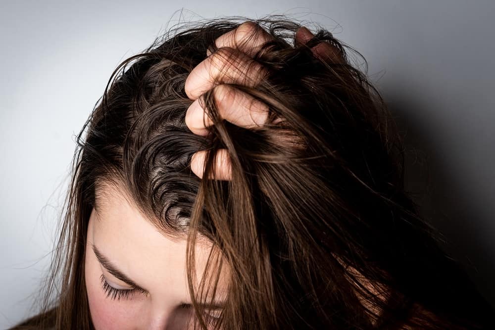 Home Remedies for Oily Hair